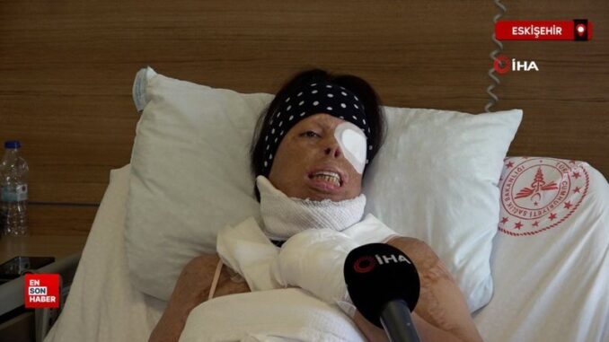 eskisehirde-genc-kadinin-hayati-karardi-5rFKDAe9.jpg